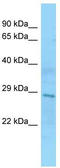 Survival Of Motor Neuron 2, Centromeric antibody, TA343297, Origene, Western Blot image 