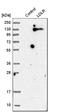 LDLR antibody, HPA009647, Atlas Antibodies, Western Blot image 