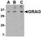 ORAI Calcium Release-Activated Calcium Modulator 3 antibody, orb74828, Biorbyt, Western Blot image 