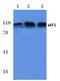 Eukaryotic Translation Elongation Factor 2 antibody, AP06094PU-N, Origene, Western Blot image 