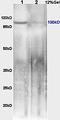 Mitogen-Activated Protein Kinase Kinase Kinase 14 antibody, orb11130, Biorbyt, Western Blot image 