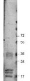 Vascular endothelial growth factor A antibody, GTX48811, GeneTex, Western Blot image 