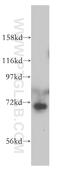 Cleavage Stimulation Factor Subunit 2 Tau Variant antibody, 14206-1-AP, Proteintech Group, Western Blot image 
