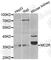 ACTH receptor antibody, A3010, ABclonal Technology, Western Blot image 