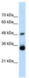 Homeobox protein Hox-C9 antibody, TA339139, Origene, Western Blot image 