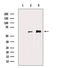 RUNX Family Transcription Factor 2 antibody, GTX00792, GeneTex, Western Blot image 