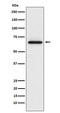 Matrix Metallopeptidase 2 antibody, M00286-3, Boster Biological Technology, Western Blot image 