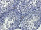 Interleukin 13 antibody, orb10895, Biorbyt, Immunohistochemistry paraffin image 