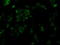 Serine Racemase antibody, GTX83567, GeneTex, Immunocytochemistry image 