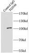 Trans-Golgi Network Protein 2 antibody, FNab08653, FineTest, Immunoprecipitation image 