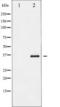NFKB Inhibitor Beta antibody, TA325732, Origene, Western Blot image 