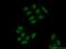 Zinc Finger CCHC-Type Containing 8 antibody, 23374-1-AP, Proteintech Group, Immunofluorescence image 