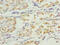 SMG6 Nonsense Mediated MRNA Decay Factor antibody, A65874-100, Epigentek, Immunohistochemistry paraffin image 