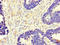 Mitochondrially Encoded Cytochrome C Oxidase I antibody, LS-C678698, Lifespan Biosciences, Immunohistochemistry paraffin image 
