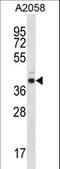 E2F Transcription Factor 3 antibody, LS-C167598, Lifespan Biosciences, Western Blot image 