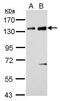 Nuclear Factor Of Activated T Cells 2 antibody, PA5-34940, Invitrogen Antibodies, Western Blot image 