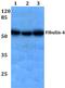 EGF Containing Fibulin Extracellular Matrix Protein 2 antibody, PA5-75395, Invitrogen Antibodies, Western Blot image 
