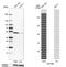 DExD-Box Helicase 39B antibody, NBP2-58594, Novus Biologicals, Western Blot image 