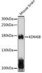 Lysine-specific demethylase 6B antibody, 14-618, ProSci, Western Blot image 