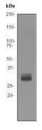 Orthodenticle Homeobox 2 antibody, TA307061, Origene, Western Blot image 
