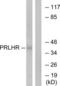 Prolactin-releasing peptide receptor antibody, LS-C120942, Lifespan Biosciences, Western Blot image 