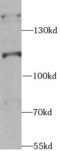 U2 SnRNP Associated SURP Domain Containing antibody, FNab08211, FineTest, Western Blot image 