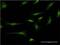 Catenin Delta 2 antibody, H00001501-M02, Novus Biologicals, Immunocytochemistry image 