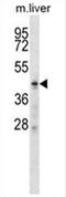 Zinc Finger DHHC-Type Containing 6 antibody, AP54639PU-N, Origene, Western Blot image 