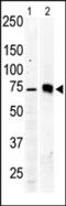 Protein kinase C beta type antibody, TA302123, Origene, Western Blot image 