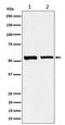 Sorting nexin-4 antibody, M08783-1, Boster Biological Technology, Western Blot image 