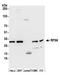 Ribosomal Protein S6 antibody, A300-556A, Bethyl Labs, Western Blot image 