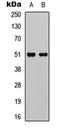 G Protein-Coupled Receptor 152 antibody, GTX55243, GeneTex, Western Blot image 