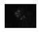 Mitotic checkpoint serine/threonine-protein kinase BUB1 antibody, LS-C82213, Lifespan Biosciences, Immunocytochemistry image 