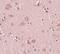 Pleckstrin Homology And RUN Domain Containing M2 antibody, PA5-20850, Invitrogen Antibodies, Immunohistochemistry paraffin image 