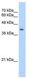 Uroporphyrinogen decarboxylase antibody, TA346183, Origene, Western Blot image 