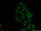 ETS Variant 5 antibody, 13011-1-AP, Proteintech Group, Immunofluorescence image 