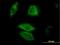 Dual Specificity Phosphatase 6 antibody, H00001848-M01, Novus Biologicals, Immunocytochemistry image 