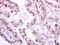 NIMA Related Kinase 2 antibody, PA5-31259, Invitrogen Antibodies, Immunohistochemistry frozen image 