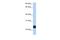 Transmembrane Protein 123 antibody, A11314, Boster Biological Technology, Western Blot image 