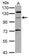 Microtubule Associated Monooxygenase, Calponin And LIM Domain Containing 1 antibody, GTX116770, GeneTex, Western Blot image 