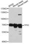 Tumor Protein P63 antibody, LS-C748028, Lifespan Biosciences, Western Blot image 