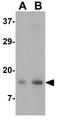 Radiation-inducible immediate-early gene IEX-1 antibody, GTX31315, GeneTex, Western Blot image 
