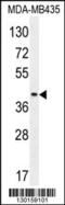 Leukocyte Immunoglobulin Like Receptor A5 antibody, 55-959, ProSci, Western Blot image 