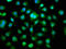 DM1 Protein Kinase antibody, LS-C670740, Lifespan Biosciences, Immunofluorescence image 
