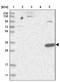 HAD antibody, NBP1-85892, Novus Biologicals, Western Blot image 