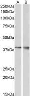 Protein Wnt-9b antibody, TA305646, Origene, Western Blot image 
