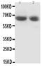 Glutamate Decarboxylase 2 antibody, PA1403, Boster Biological Technology, Western Blot image 