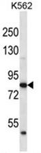 Ankyrin Repeat And BTB Domain Containing 2 antibody, AP50034PU-N, Origene, Western Blot image 