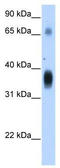 Ccn3 antibody, TA332127, Origene, Western Blot image 