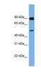 Family With Sequence Similarity 160 Member B1 antibody, NBP1-57822, Novus Biologicals, Western Blot image 